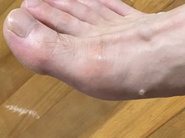 どのような症状?